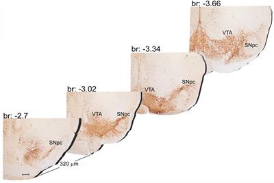 Systematic Morphometry of Catecholamine Nuclei in the Brainstem